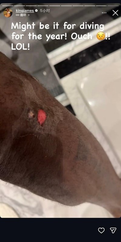 勒布朗拼尽全力倒地抢球;腿伤照片曝光后球迷心疼不已。 体育新闻 勒布朗拼尽全力倒地抢球;腿伤照片曝光后球迷心疼不已。 体育新闻 勒布朗拼尽全力倒地抢球;腿伤照片曝光后球迷心疼不已。 体育新闻 勒布朗拼尽全力倒地抢球;腿伤照片曝光后球迷心疼不已。 体育新闻